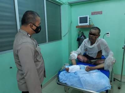 Penjaga malam di Sibolga dibakar OTK.(istimewa).