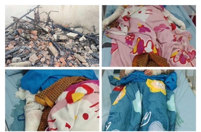 Terbakar, 4 Warga Desa Benda Sukamulya Terkapar Di RSUD Balaraja