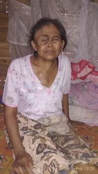 Penderita Kanker di Pandeglang Butuh Bantuan