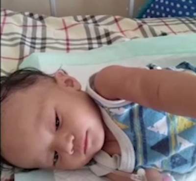 Usai Jalani Perawatan Balita Penderita Usut Kejepit di Kota Serang Telah Pulangkan