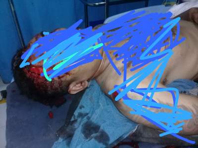 Warga Budimulya Tewas Dikeroyok Pembalap Liar